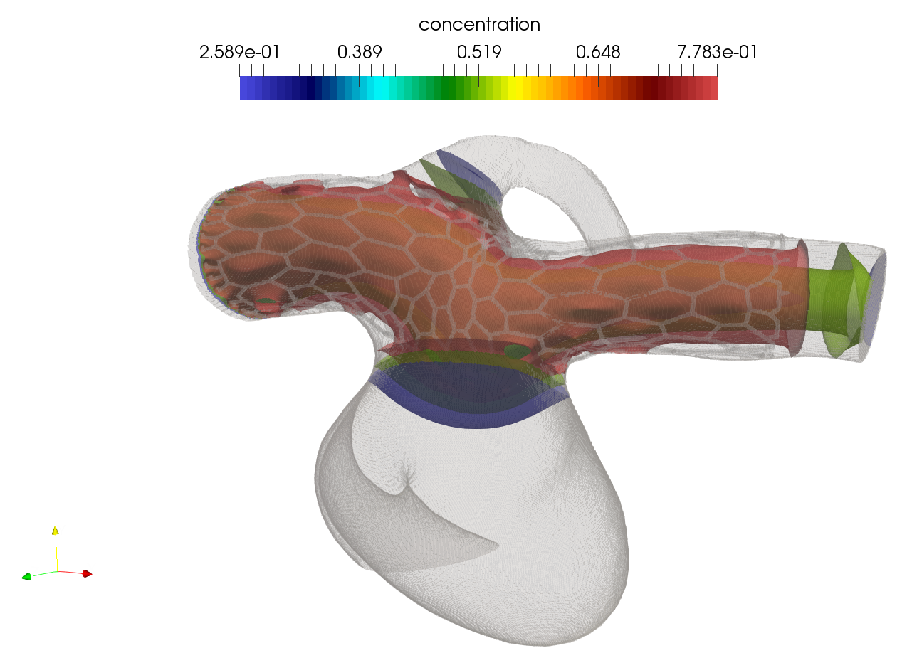 Visualization of a virtually stented aneurysm